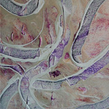 Alluvial