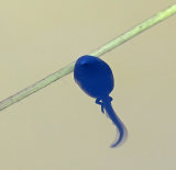 Tadpoles