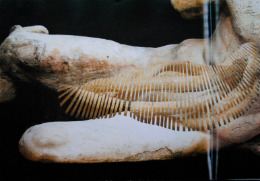 Suture Series (Point of Juncture)