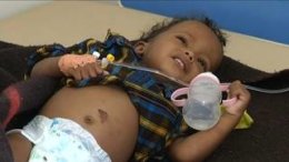 Yemen's cholera epidemic, a humanitarian disaster