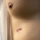 Torso eines Mannes mit Narbe unter der Brust