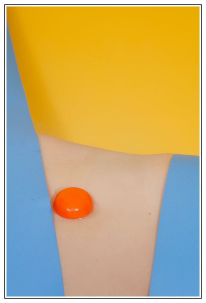 Egg