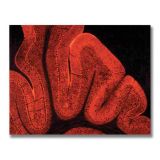 Cerebellum 1, Acrylic on Canvas, 92 x 72cm