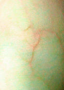 Siloën’s arm <br>
[digital print 2008, edition of 1]