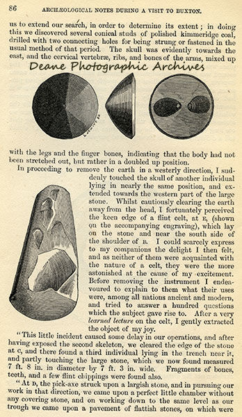Lukis at Buxton Derbyshire 1865 Page 7