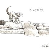 Acupuncture