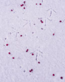 Footprints and Berries