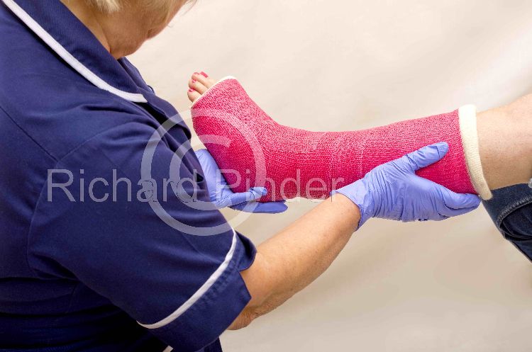 Nurse tending a Broken Ankle