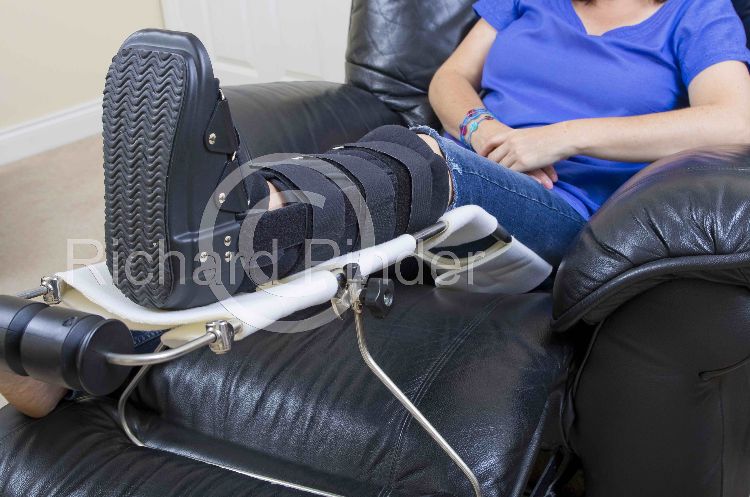 Leg in a Support Splint resting on a frame