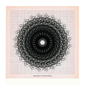 Anatomical digital drawing of uterus front specimen by Sally Butcher Fine Art