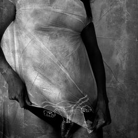 Anatomised II