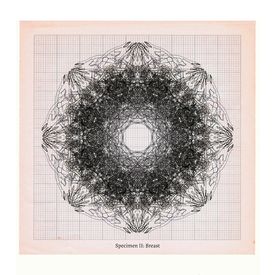 Anatomical digital drawing of breast specimen by Sally Butcher Fine Art