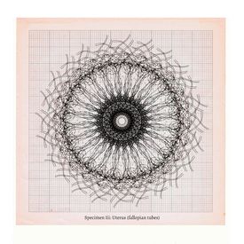 Anatomical digital drawing of uterus fallopian tubes specimen by Sally Butcher Fine Art