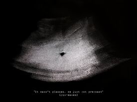 black and white sonogram image of a navel, about infertility