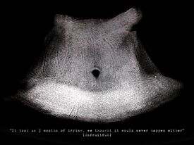 black and white sonogram image of a navel, about infertility