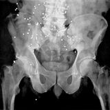 Gunshot 2 Charcoal on Paper 115x122cm