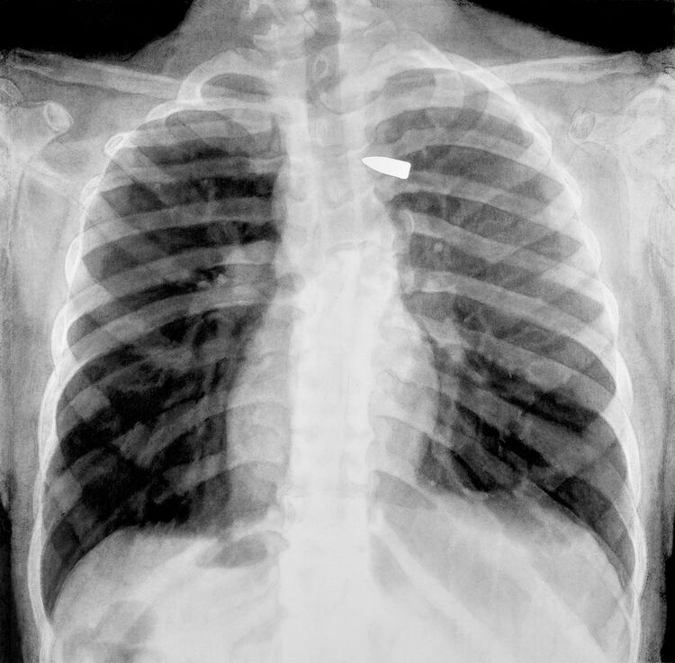 Gunshot 4 Charcoal on Paper 116x118cm