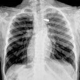 Gunshot 4 Charcoal on Paper 116x118cm