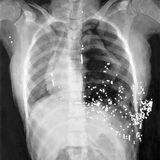 Gunshot 5 Charcoal on Paper 113x126cm