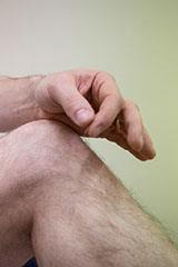Acupuncture