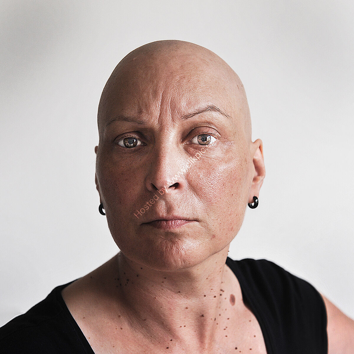 Self and chemo