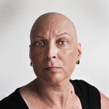 Self and chemo